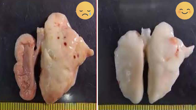 Case 03