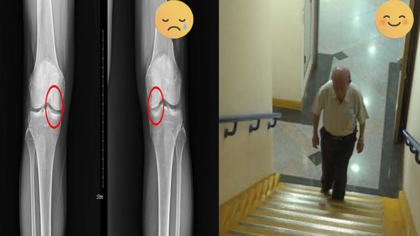 Case 04